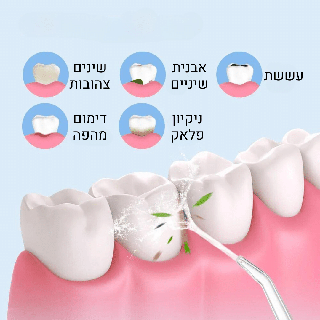 סילונית נקיון שיניים