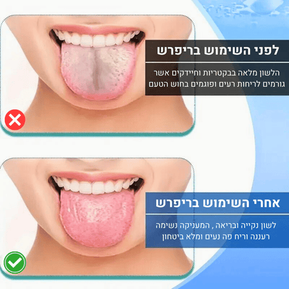 ריפרש- מחסל ריחות רעים מהפה ומעניק נשימה רעננה